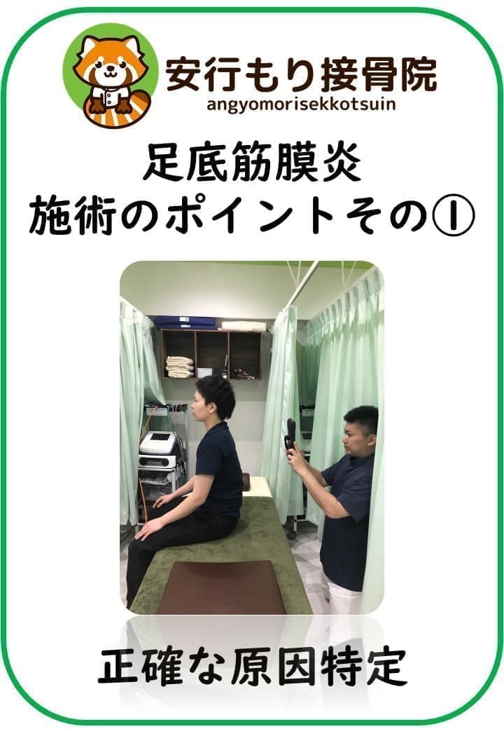 足底筋膜炎の施術ポイント①