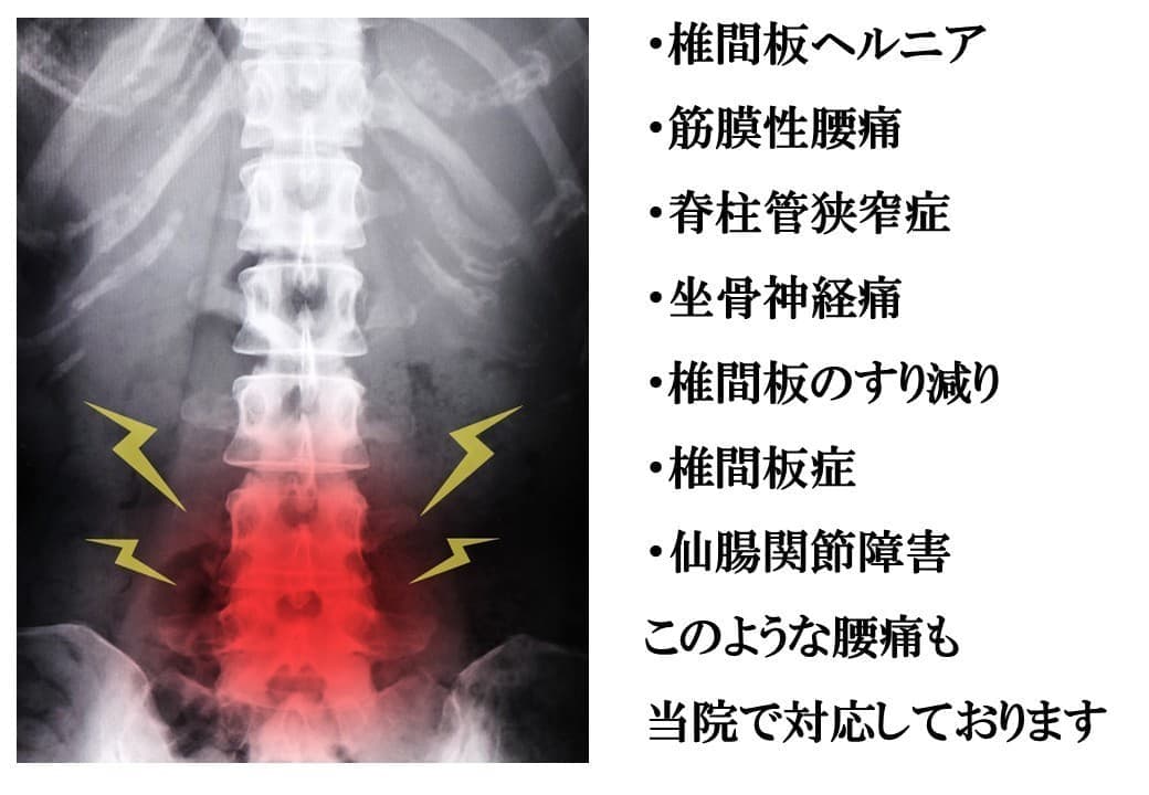 代表的な診断名