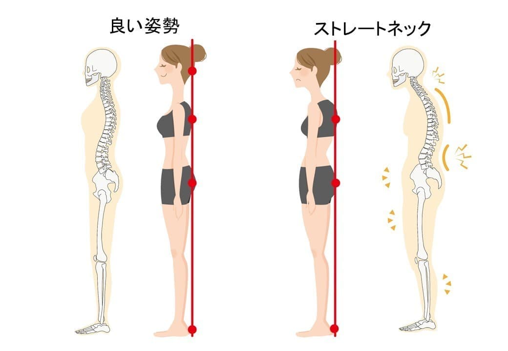 良い姿勢とストレートネック
